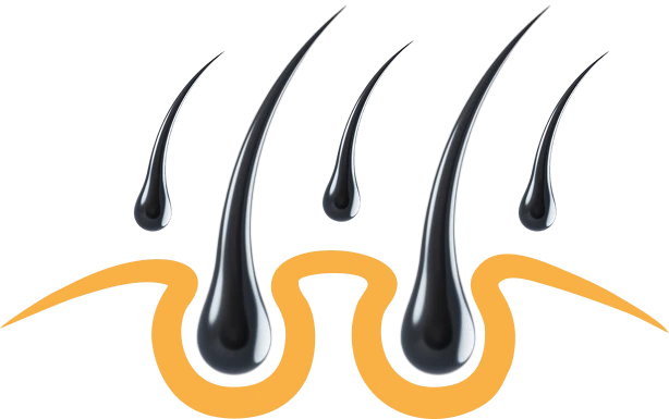 ПЕРЕСАДКА ВОЛОС