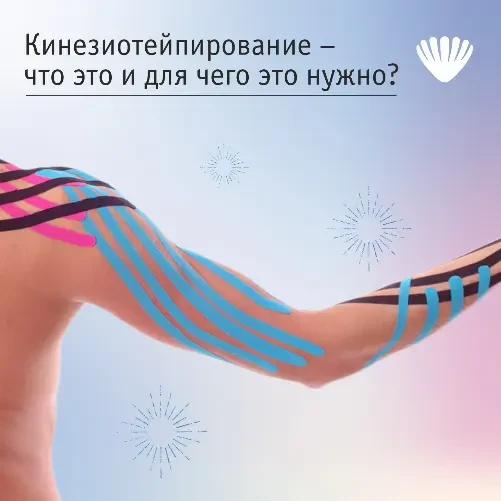 Кинезиотейпирование – что это и для чего нужно?