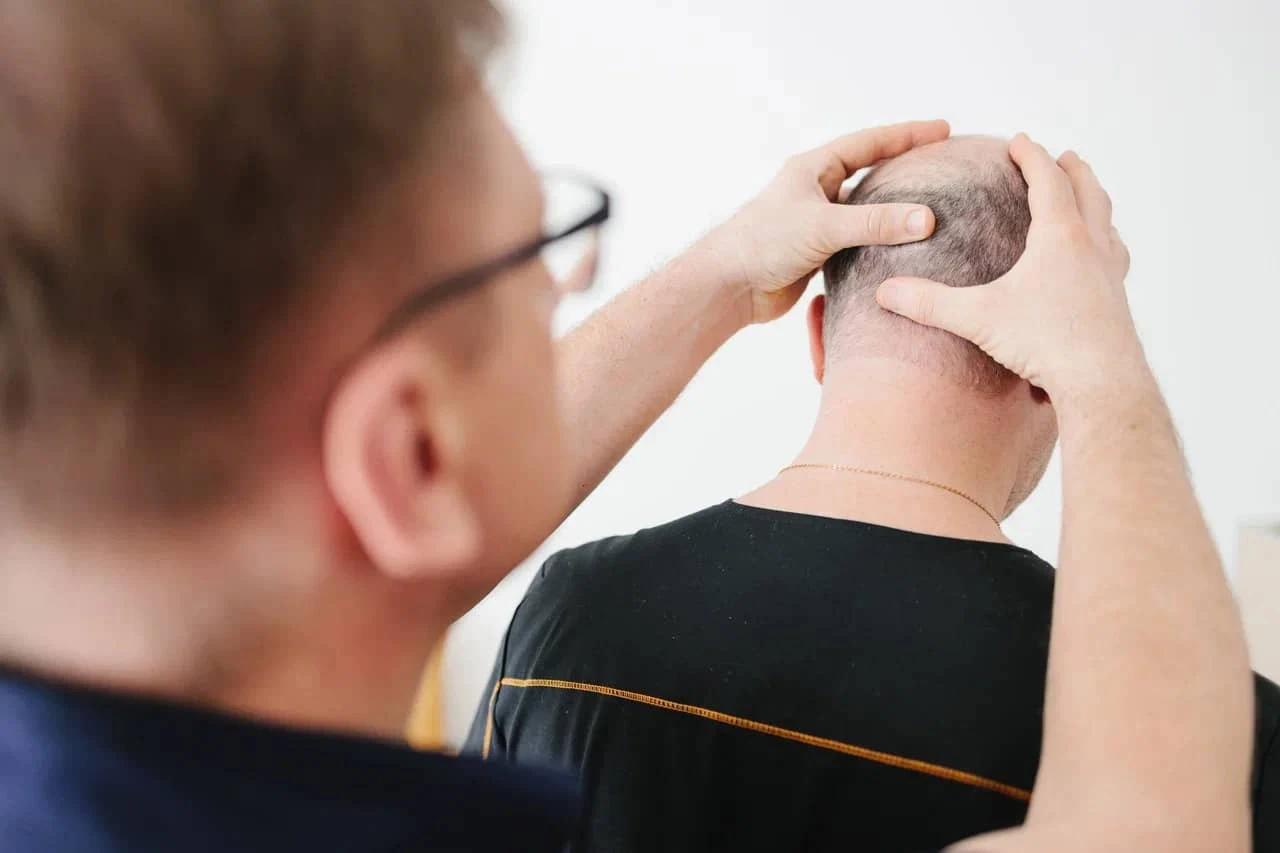 Как сохранить волосы и предотвратить облысение: советы специалиста