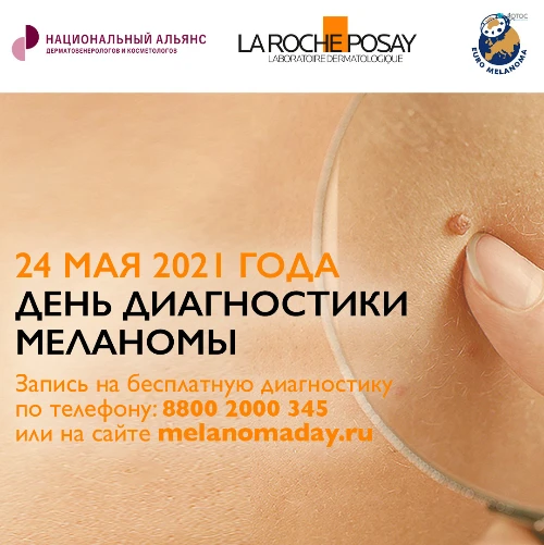 24 мая 2021 г. – День диагностики меланомы
