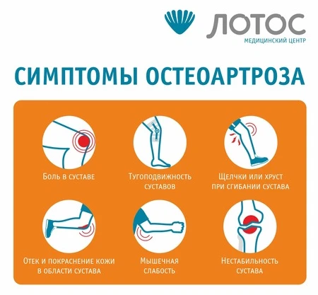 Остеоартроз может помешать вам вести активный образ жизни