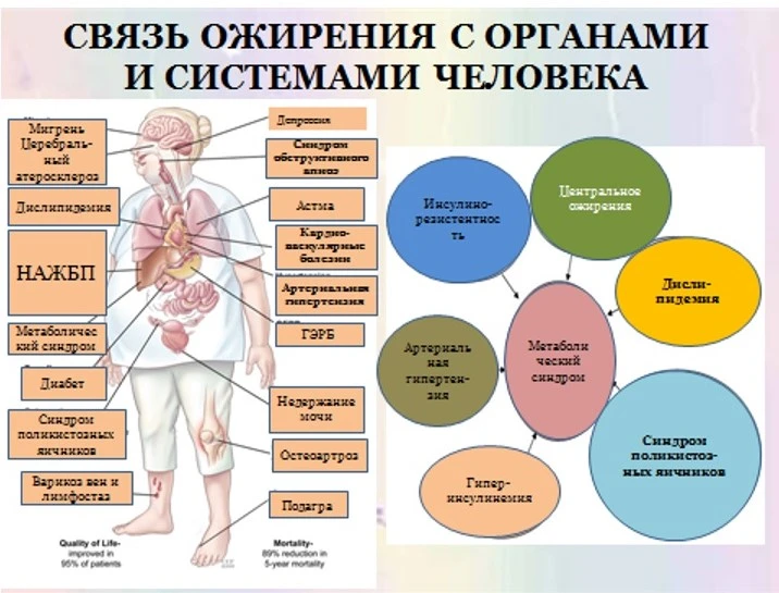 связь ожирения.jpg