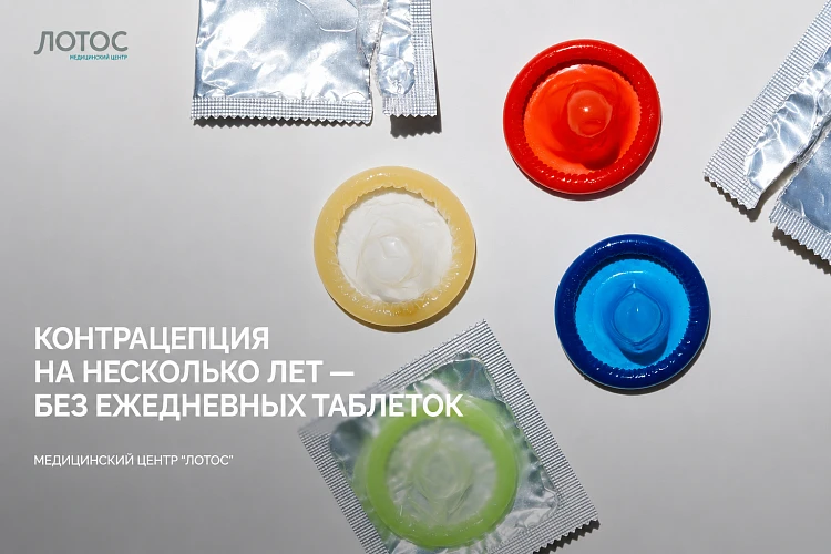Контрацепция на несколько лет — без ежедневных таблеток