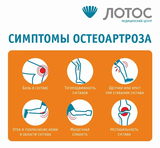 Остеоартроз может помешать вам вести активный образ жизни