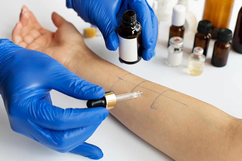 Аллергология в "ЛОТОСе"