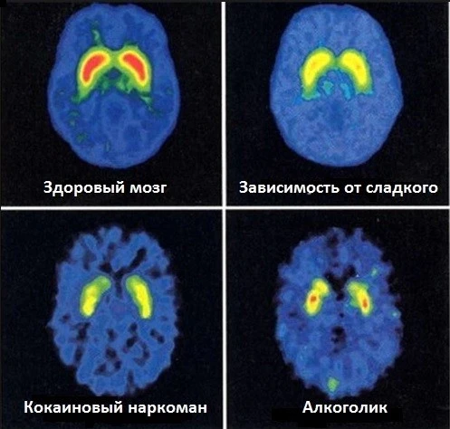 Почему нельзя есть сахар? Основные причины и последствия употребления сахара